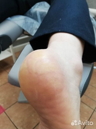 Маникюр, Педикюр, подолог