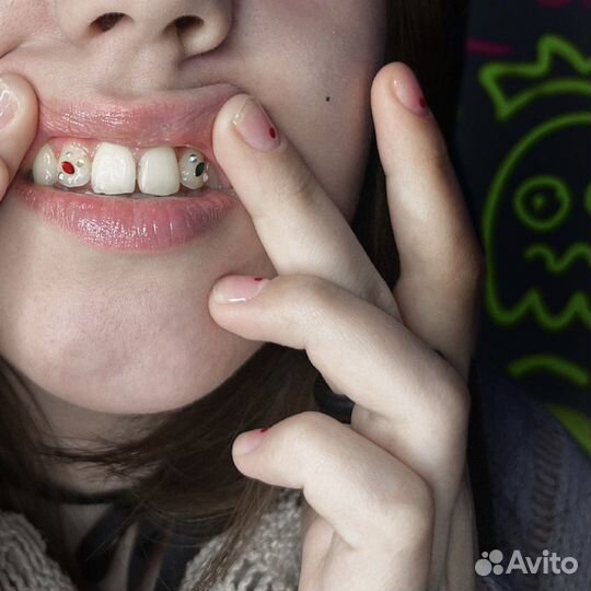 Установка скайсов, скайсы