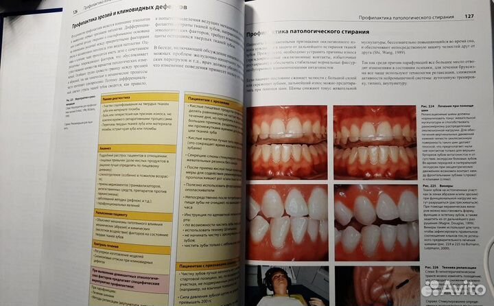 Книга стоматологии Профессиональная профилактика