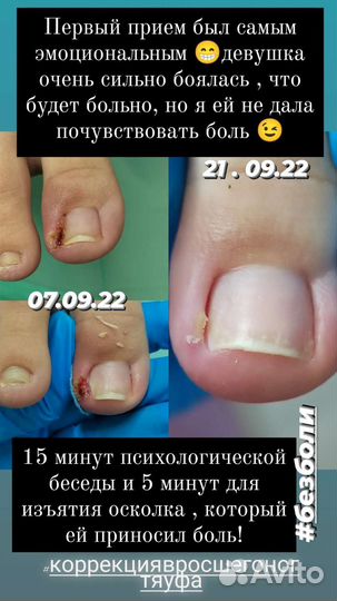 Услуги подолога с выездом на дом