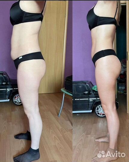 Антицеллюлитный массаж