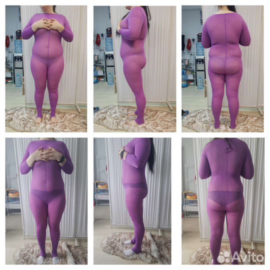 LPG. аппаратное удаление волос