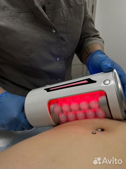 LPG.Криолиполиз.Слимсфера