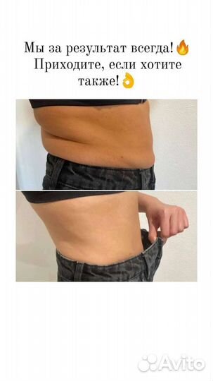 Кавитация, вибро массаж, LPG массаж