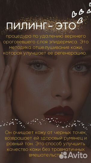 Пилинг