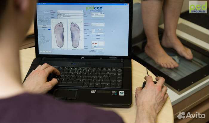 Изготовление ортопедических стелек