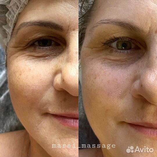 Массаж Шугаринг Новопокровская