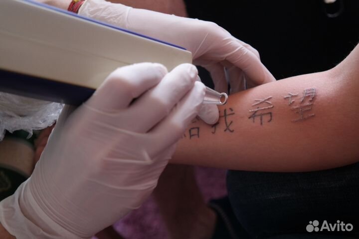 Лазерное удаление татуировок и татуажа