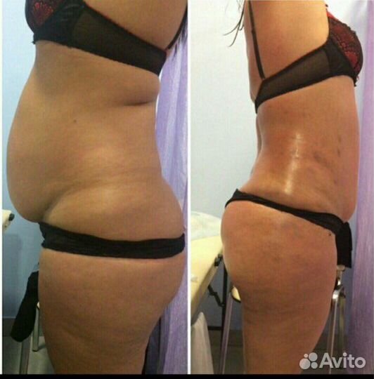 Нужны Модели косметологу