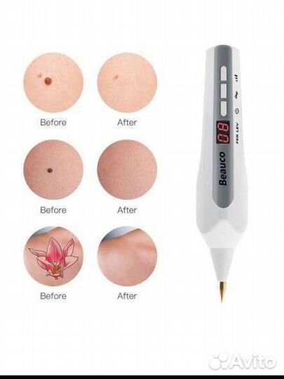 Плазменный коагулятор Beauco (Plasma Pen) SK-215