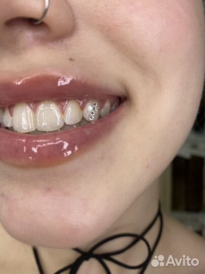 Скайсы установка