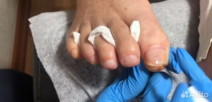 Педикюр для пожилых с выездом на дом