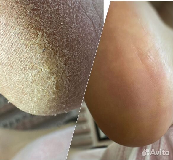 Подолог в центре