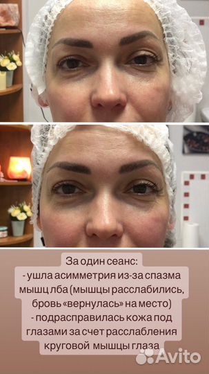 Массаж лица Кобидо, буккальный, гуаша, миофасц-й