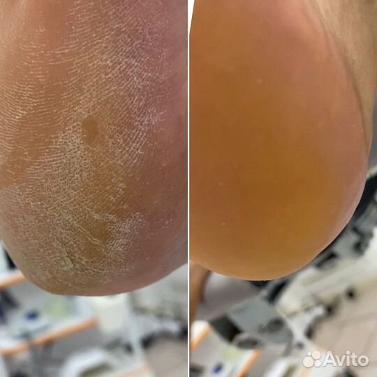 Подологический уход любой сложности