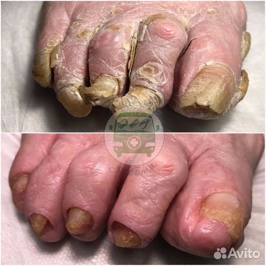 Мытьё и купание лежачих и пожилых на дому. Выезд