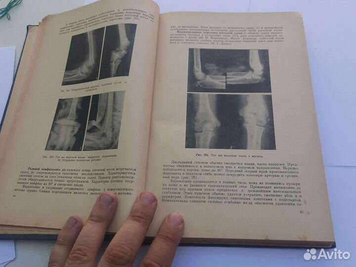 Детская хирургия. А. П. Биезинь