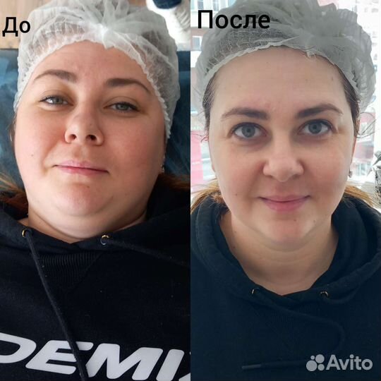 Аппаратный массаж тела и лица