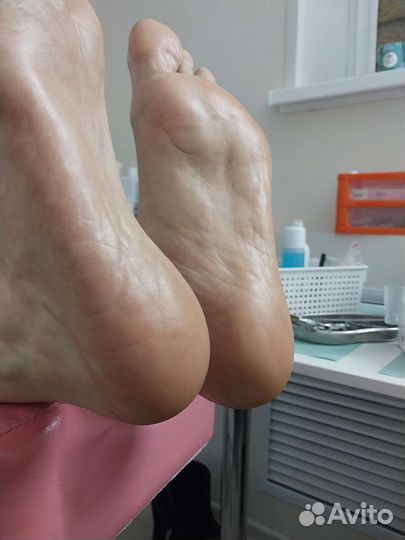 Smart педикюр