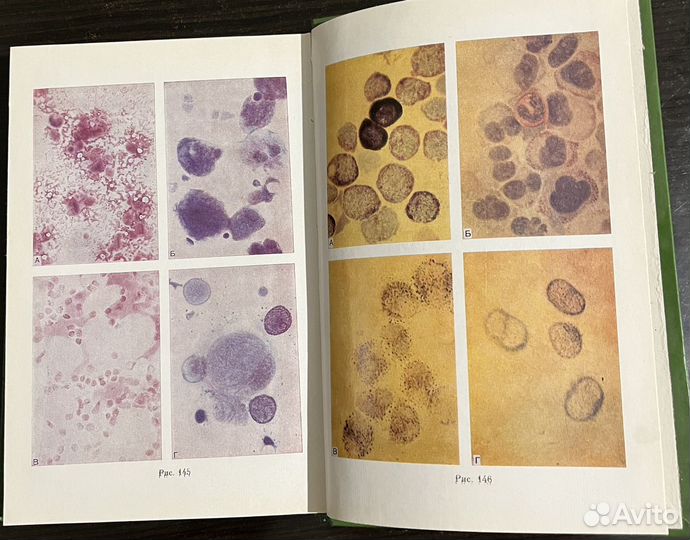 Гематологическая цитохимия