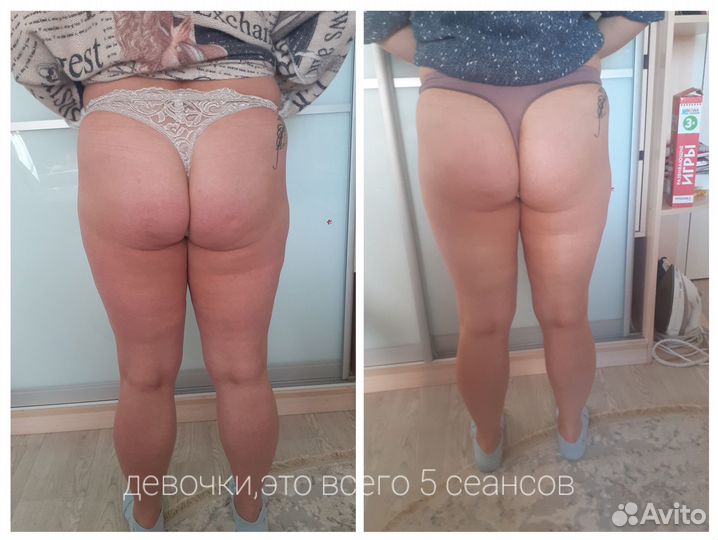 Массаж лица, безоперационное омоложение