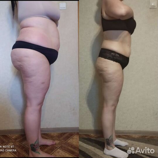 Массаж, грудничковый массаж