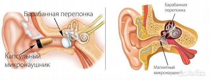 Микронаушник с камерой