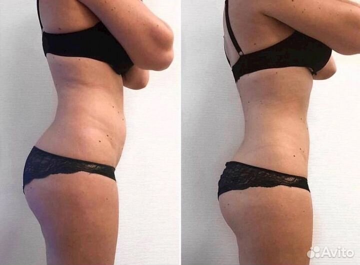 Массаж аппаратный антицеллюлитный