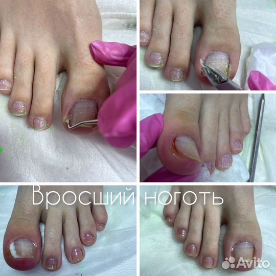 Подолог/ педикюр