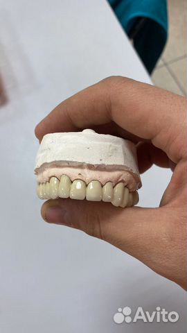 Зубные протезы