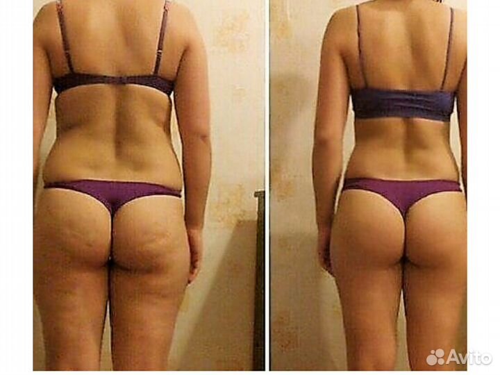 Коррекция фигуры и лица