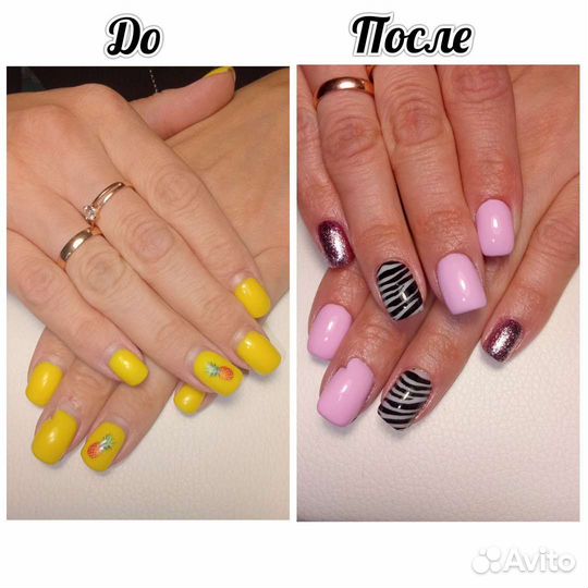 Снятие гель-лака с ногтей на руках