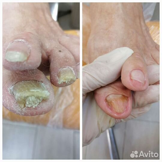 Подолог студия подологии выезд на дом