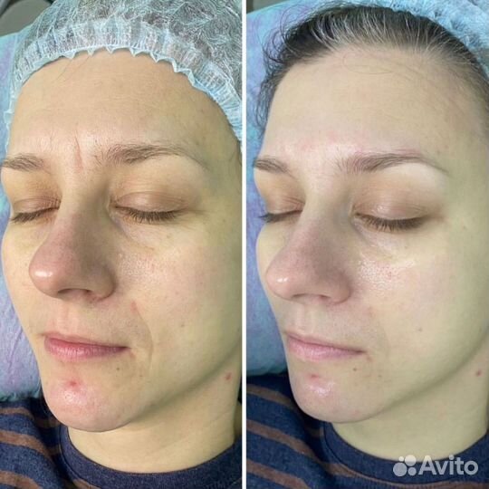 Массаж лица обучение Казань