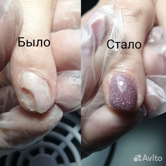 Педикюр, подология и эстетика