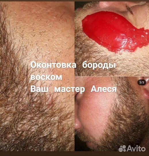 Депиляция Шугаринг,S'kins (мужской/женский) Реутов