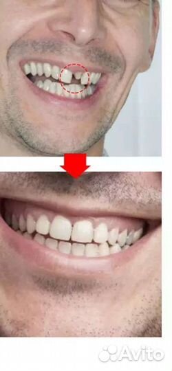 Литые горошки для зубов цена за 1 пакет