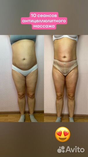 Антицеллюлитный массаж ручной