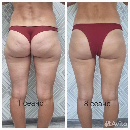 Массаж на дому