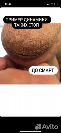 Маникюр и педикюр