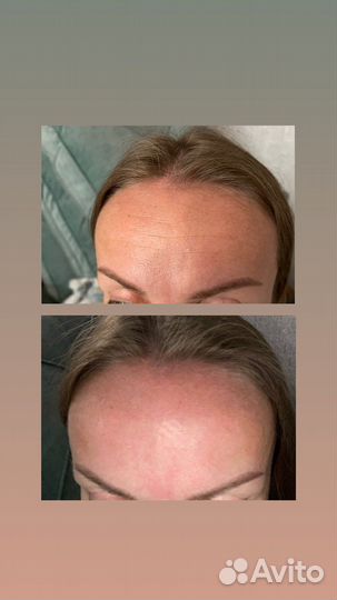 Классический массаж