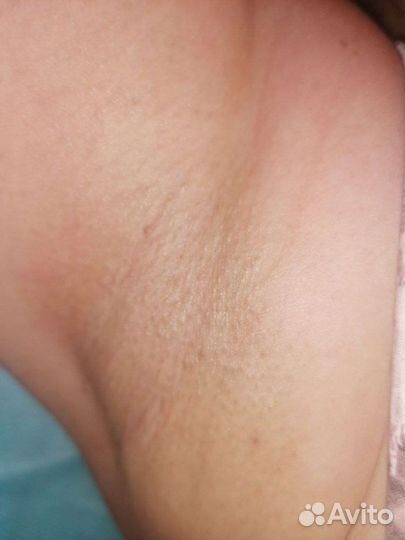 Шугаринг на дому сахарной пастой