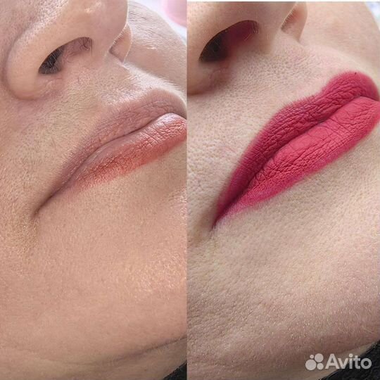 Шугаринг и Восковая депиляция