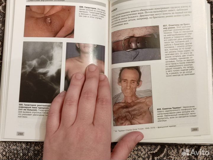 Симптомы внутренних болезней, М. Затурофф