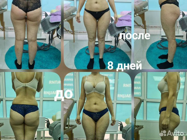 Похудение, коррекция фигуры