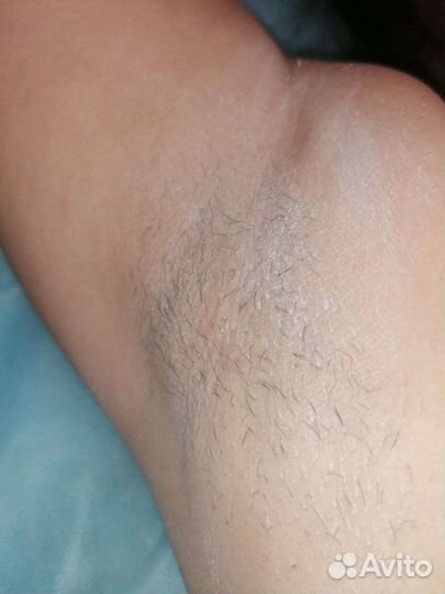 Шугаринг на дому сахарной пастой