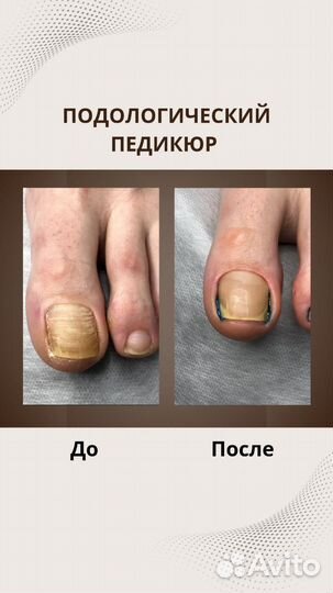 Подолог Мария Мусихина