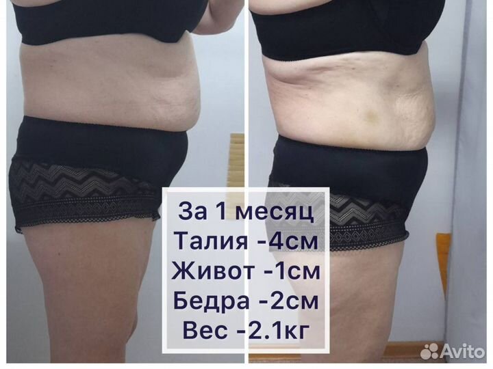 Массаж проблемных зон - 5 см за курс