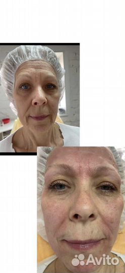 Сыворотка vl26g