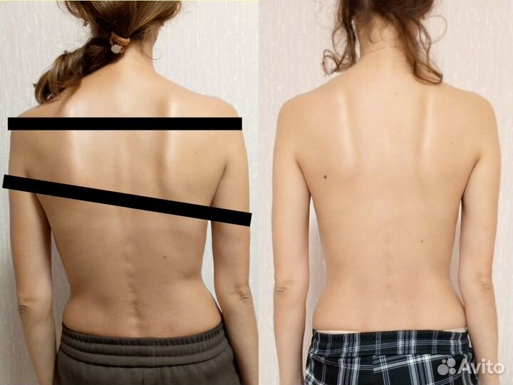 Массаж лица и тела